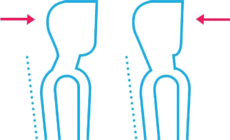 cervicale